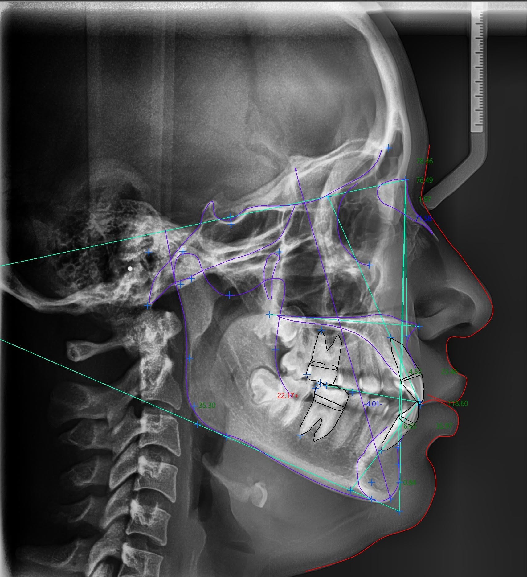 RADIOGRAFIA PANORAMICA DENTAL