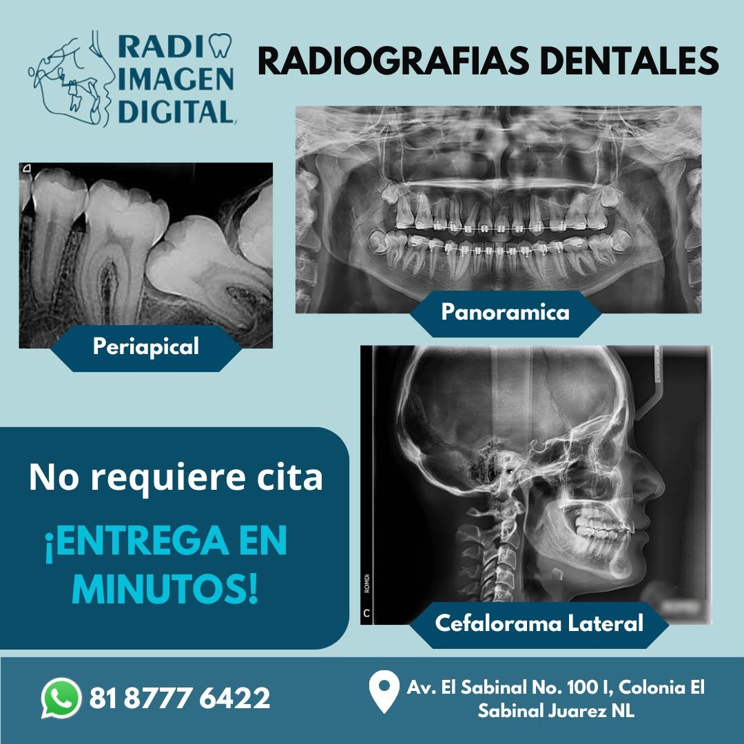 RADIOGRAFIA PANORAMICA DENTAL