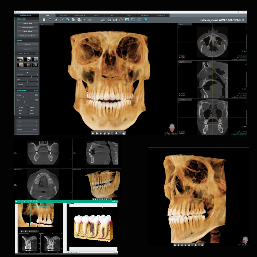 RADIOGRAFIA PANORAMICA DENTAL