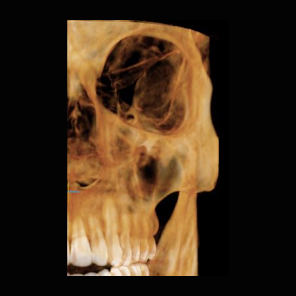 Radiografía Panorámica Dental RXS Tomografía o Cone Beam Dental