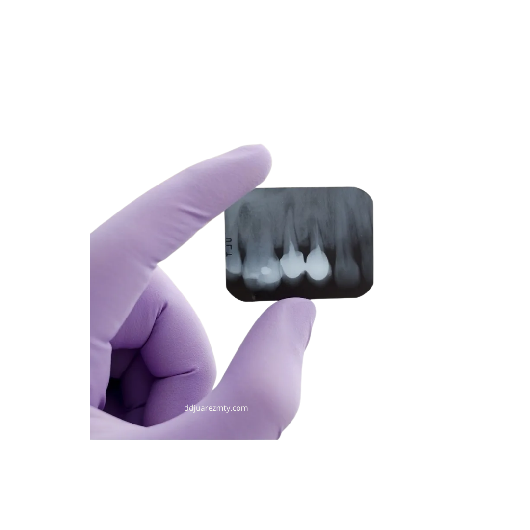 RADIOGRAFIA PANORAMICA DENTAL